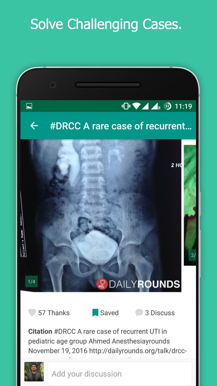 Anaesthesia Rounds with Calculator screenshot image 4_Popularmodapk.com