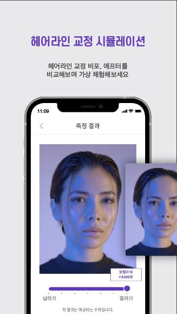 위드비컨(WithBecon) 탈모 및 두피 케어 솔루션 screenshot image 16_Popularmodapk.com