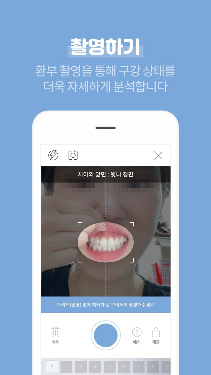 이아포(e.apo) – 집에서하는 셀프 구강검진 screenshot image 10_Popularmodapk.com