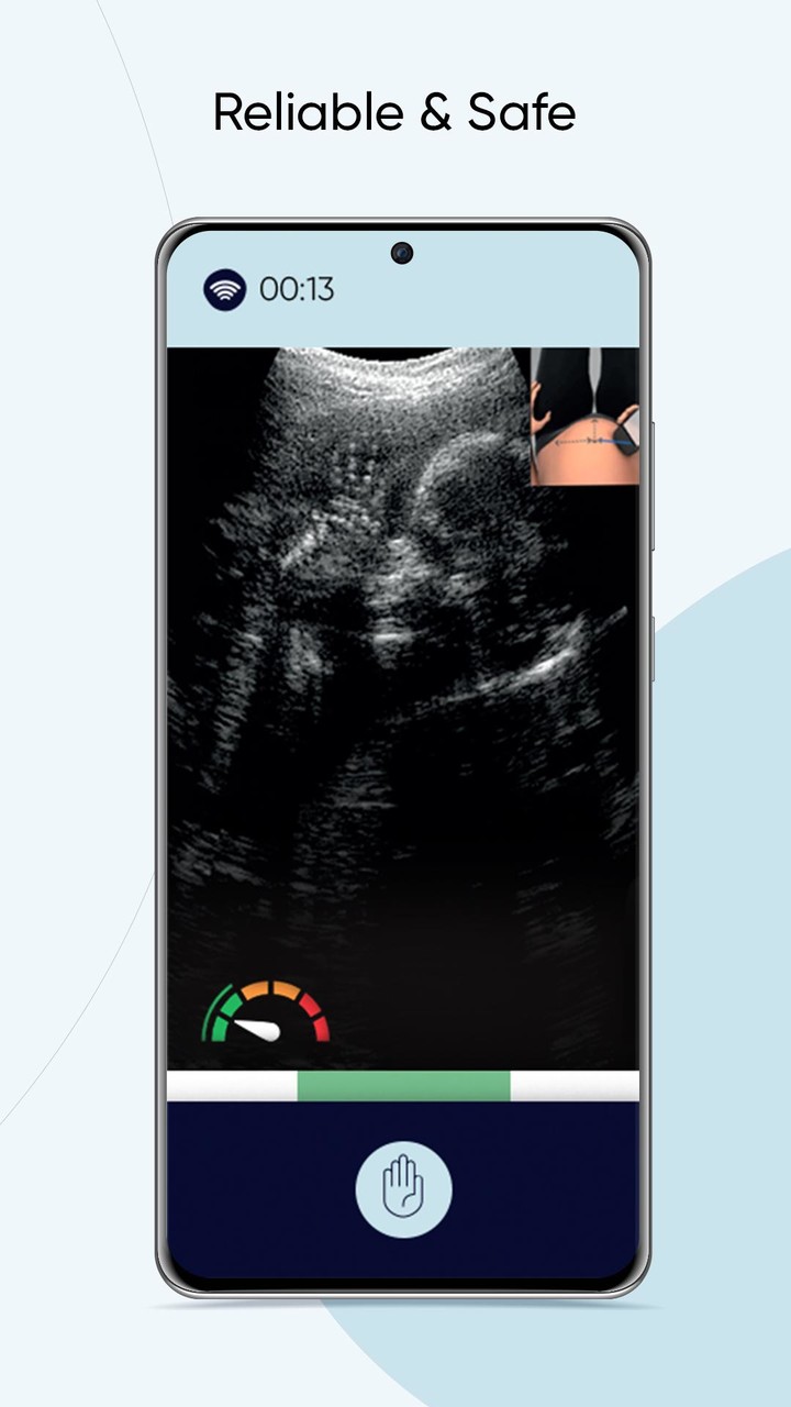 Pulsenmore screenshot image 3_Popularmodapk.com