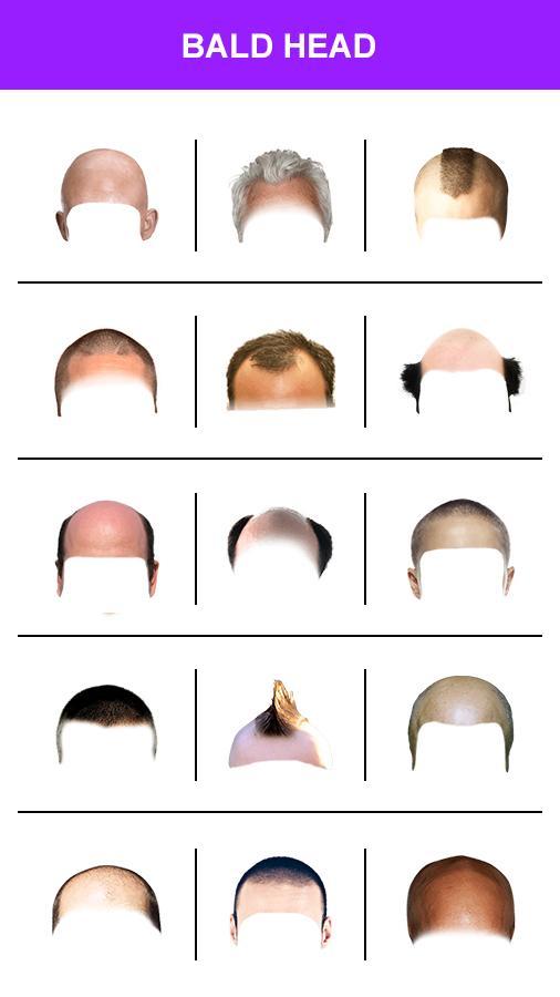 Make Me Bald Photo Editor 2022 screenshot image 5_Popularmodapk.com