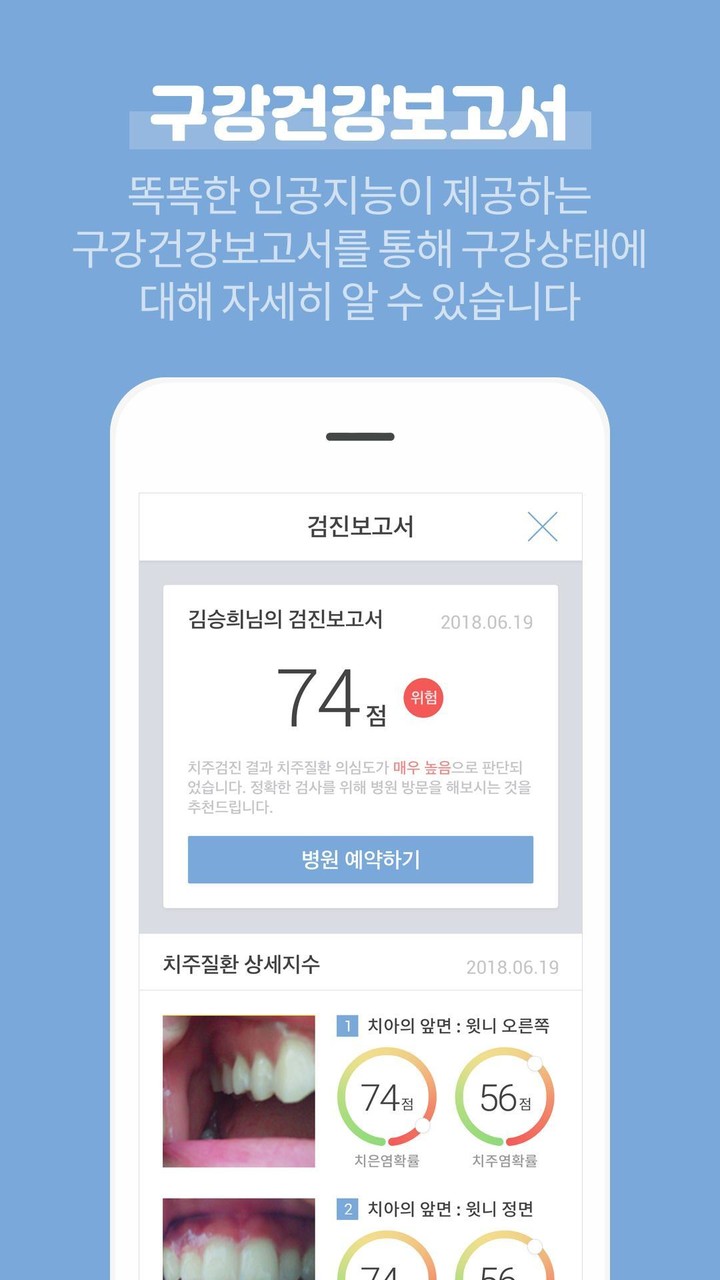 이아포(e.apo) – 집에서하는 셀프 구강검진 screenshot image 11_Popularmodapk.com