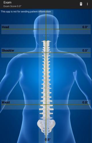 Posture Perfect Exam screenshot image 2_Popularmodapk.com