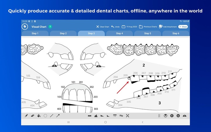 Pimbury Dental: Equine Dentistry Charting screenshot image 6_Popularmodapk.com
