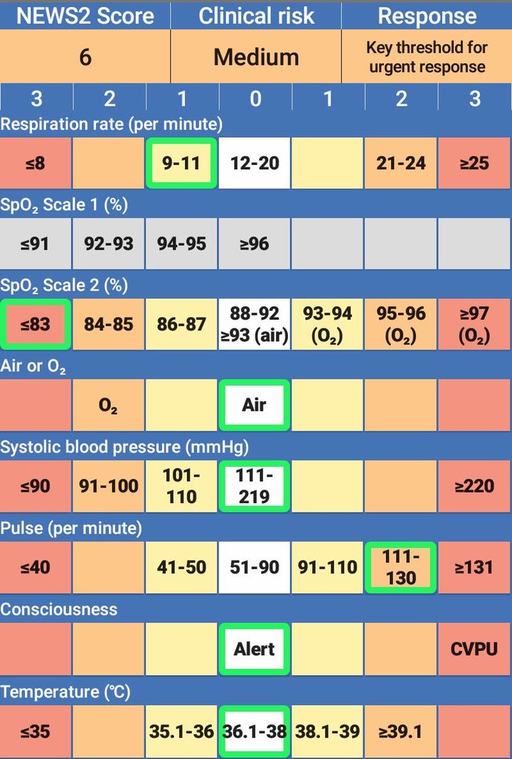 NEWS2 Chart screenshot image 4_Popularmodapk.com