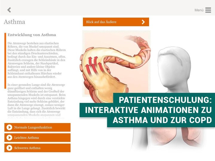 PneumoDoc screenshot image 11_Popularmodapk.com