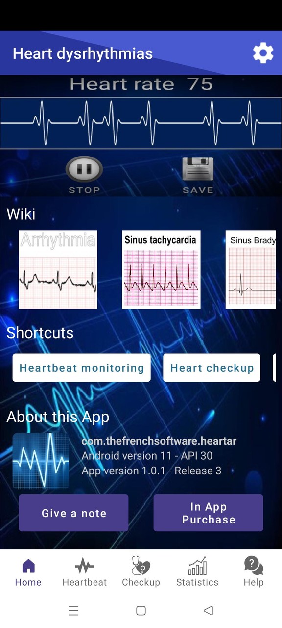 Heart dysrhythmias screenshot image 3_Popularmodapk.com