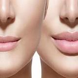 تكبيرالشفايف وتوريدهافي المنزل1_Popularmodapk.com