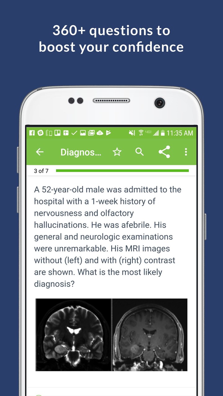 外星人冒险：自由落体破解版<span>(mod)</span> screenshot image 2_Popularmodapk.com