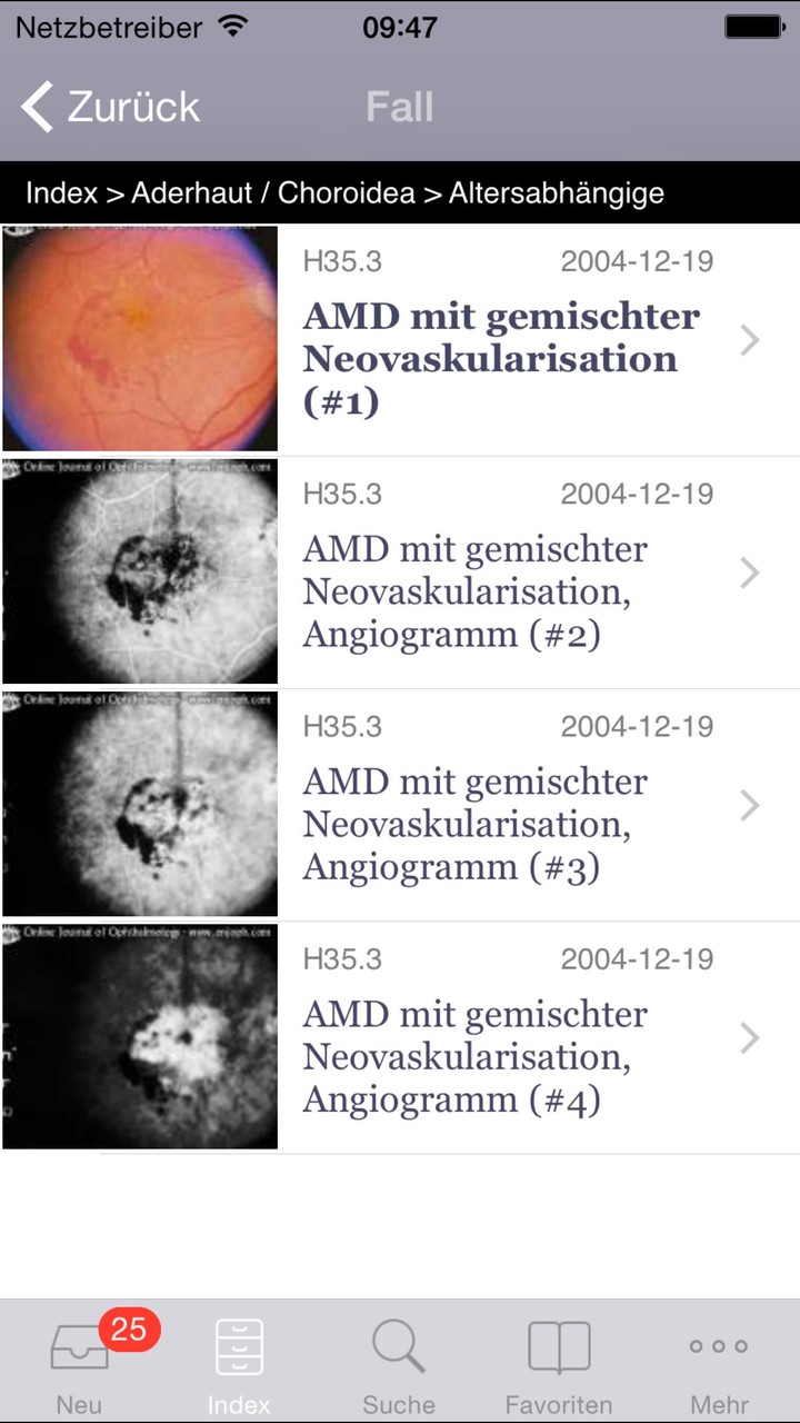 Atlas of Ophthalmology Onjoph screenshot image 2_Popularmodapk.com