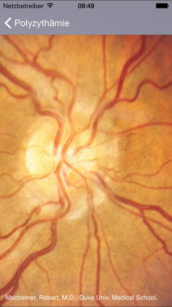 Atlas of Ophthalmology Onjoph screenshot image 4_Popularmodapk.com